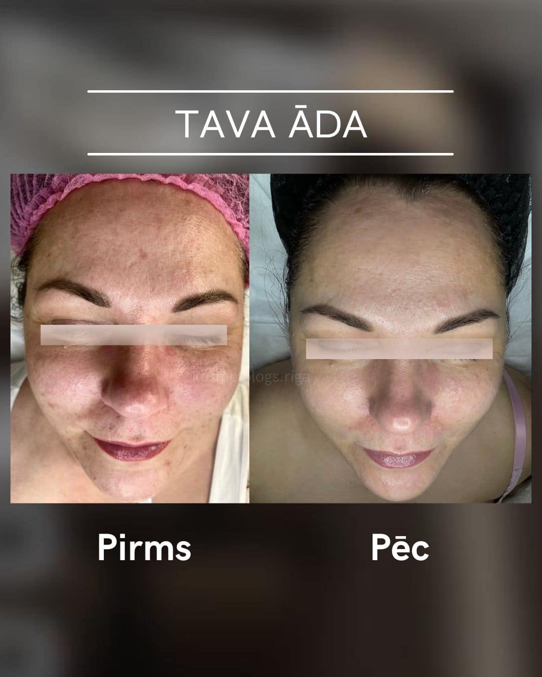 Tava-ada-parvertibas 5