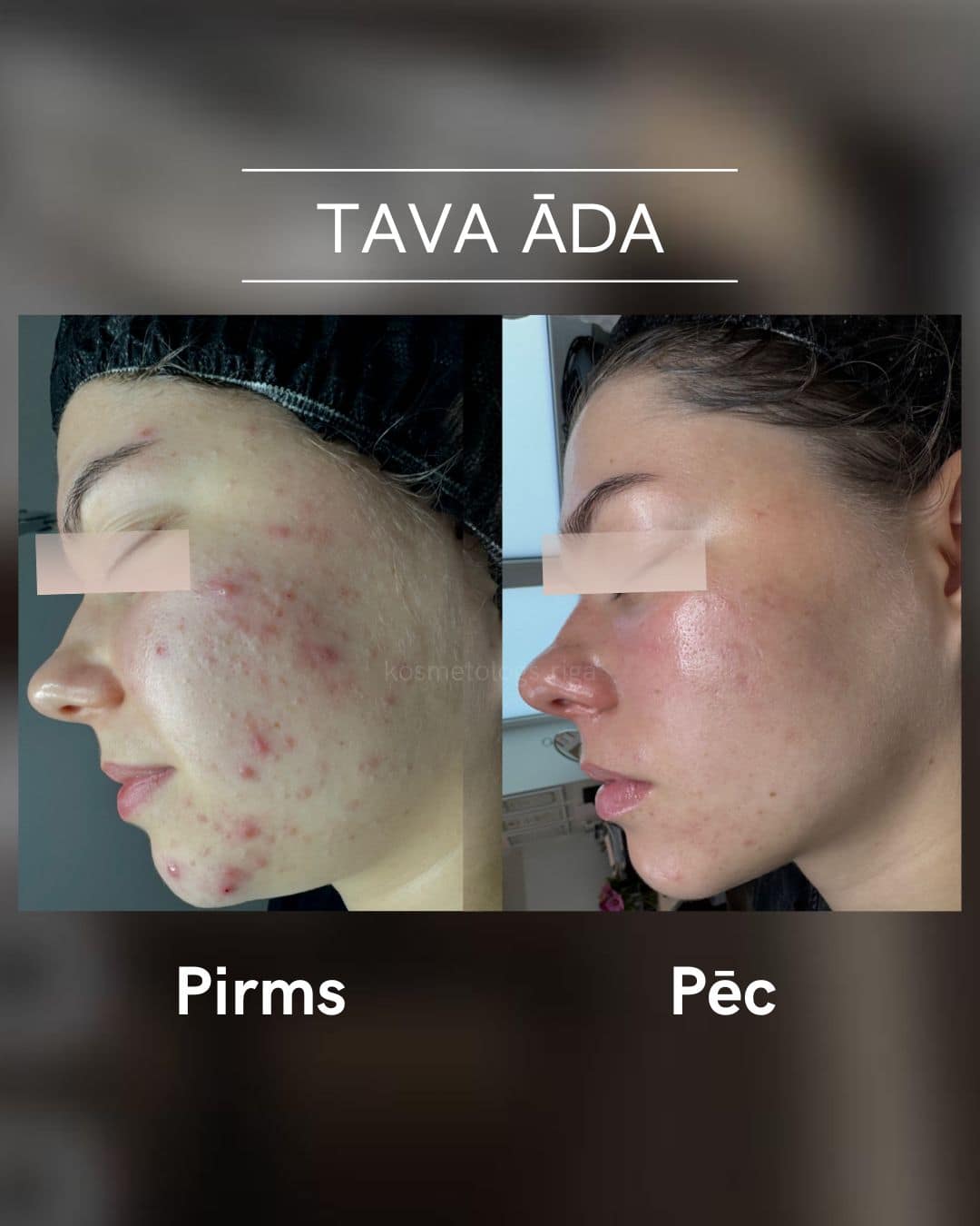 Tava-ada-parvertibas 4