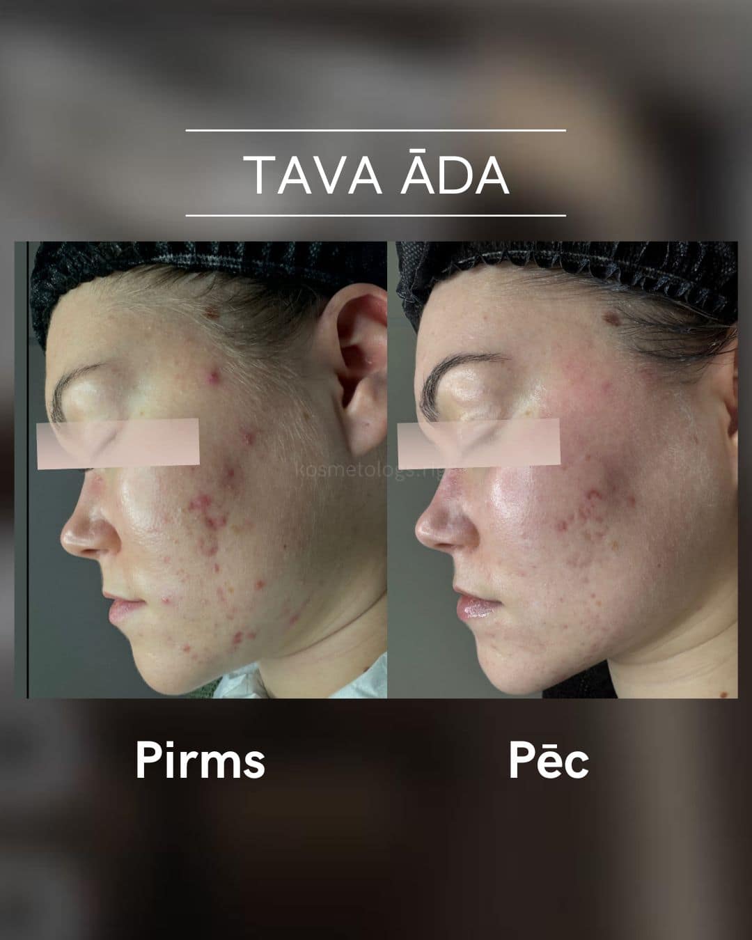 Tava-ada-parvertibas 3