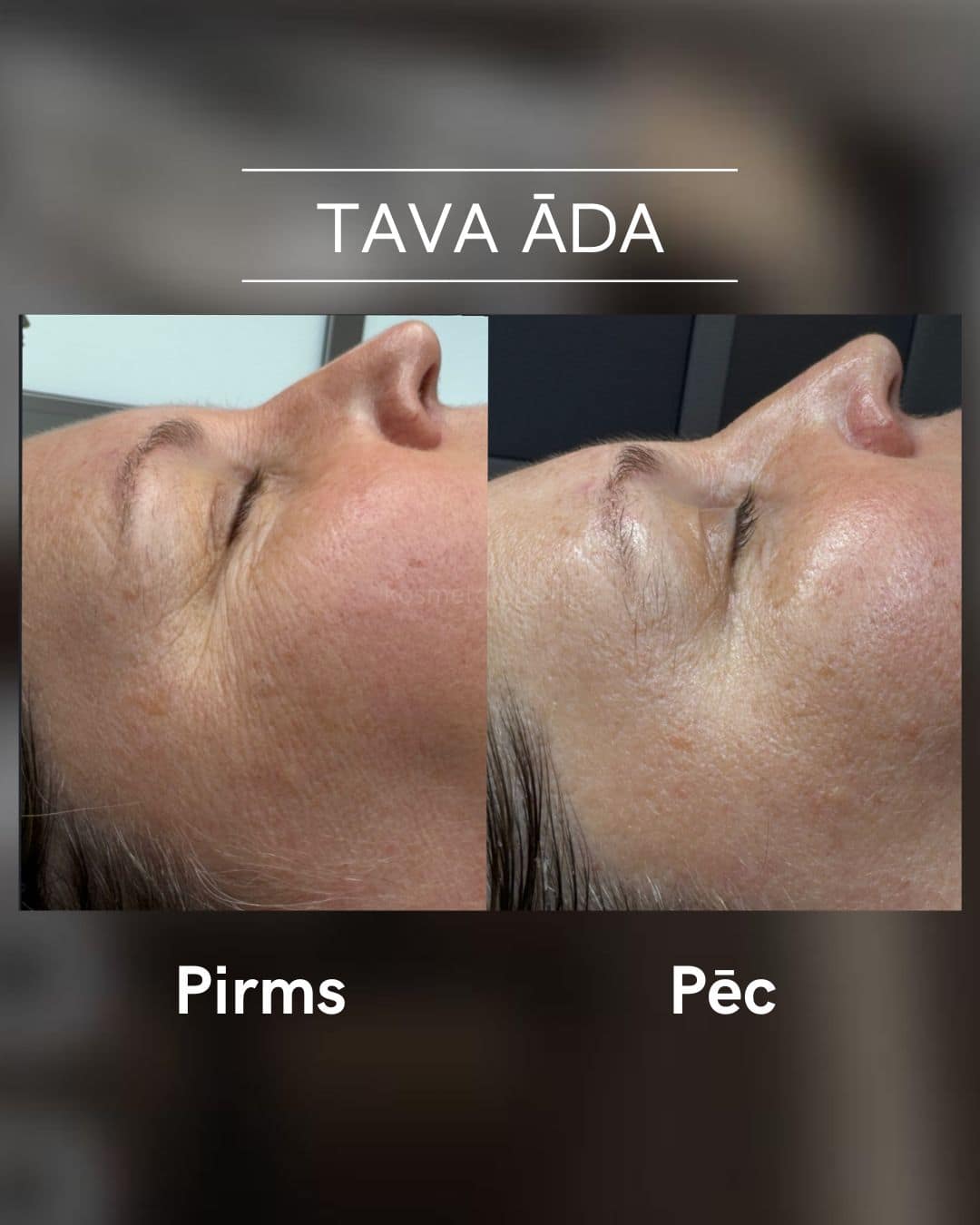 Tava-ada-parvertibas 2