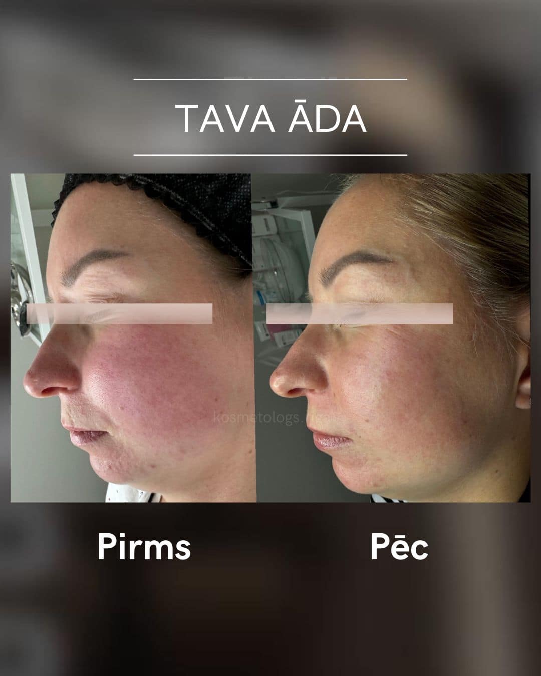 Tava-ada-parvertibas 10