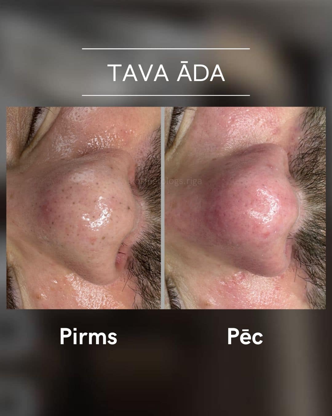 Tava-ada-parvertibas 9