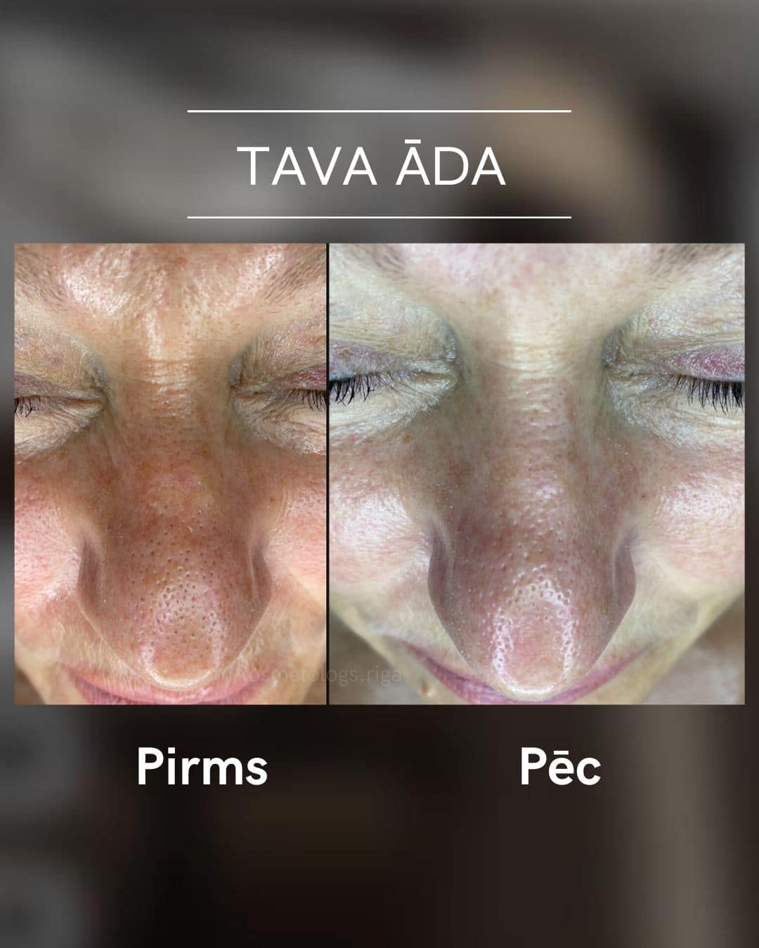 Tava-ada-parvertibas 7